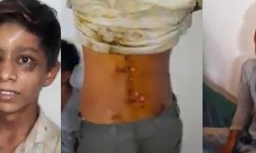 आगरा में RO प्लांट के मालिक ने चोरी के शक में पूरे परिवार को बनाया बंधक, करंट लगाकर दीं भयानक यातनाएं