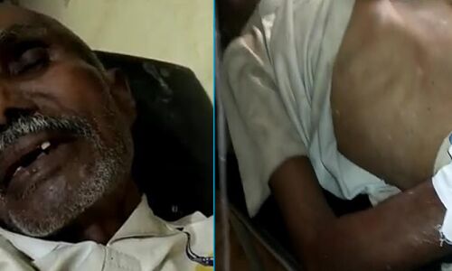 गुंडों के सामने दुम हिलाने वाली UP पुलिस ने गरीब बुजुर्ग किसान को पीटकर किया मरणासन्न