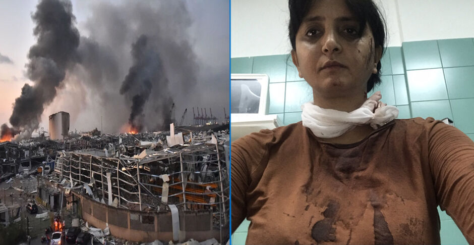 बेरूत में हुए भीषण विस्फोट में भारतीय पत्रकार भी घायल, अस्पताल में भर्ती