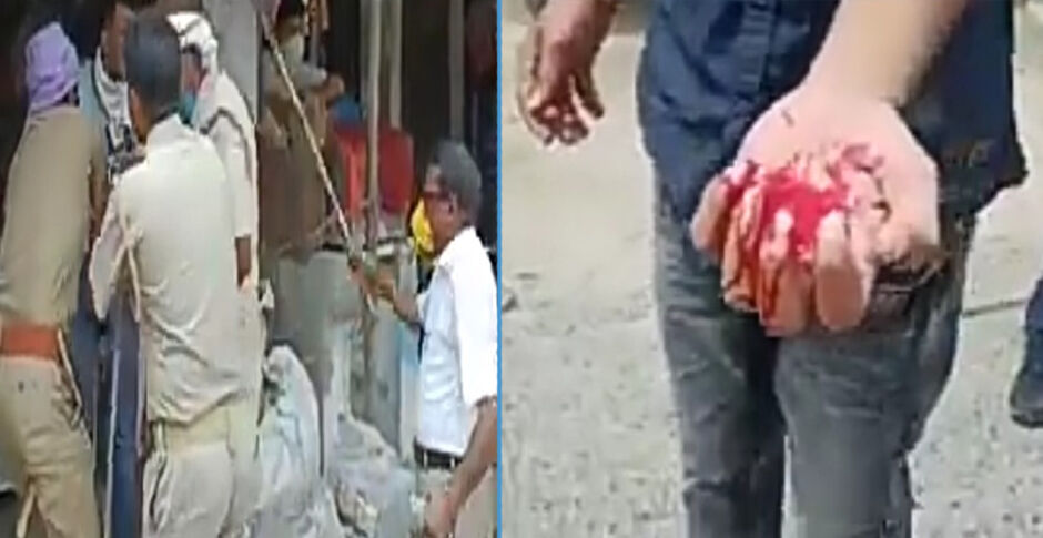 यूपी : मास्क की जगह गमछा या रूमाल पहनने वालों को एसडीएम और पुलिस ने दौड़ा-दौड़ाकर पीटा