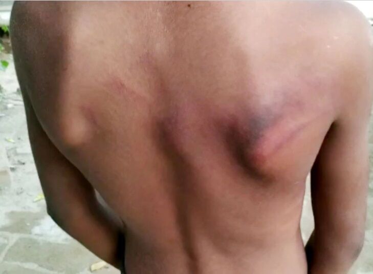 लखनऊ में पढ़ाई में कमजोर 8 साल के बच्चे पर ट्यूशन टीचर का बरपा सितम, तार से बांधकर डंडों से बुरी तरह पीटा