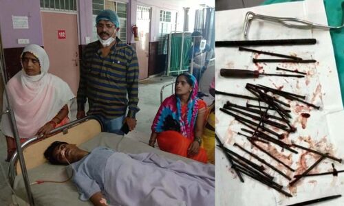 UP: 2 बेटियों का मानसिक बीमार पिता खाने लगा लोहा, ऑपरेशन में जो निकला डॉक्टरों के भी उड़े होश