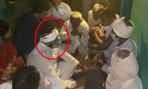 आप विधायक कुलदीप कुमार पर महामारी एक्ट के तहत केस दर्ज, कोरोना पॉजिटिव होने के बाद पहुंचे थे हाथरस