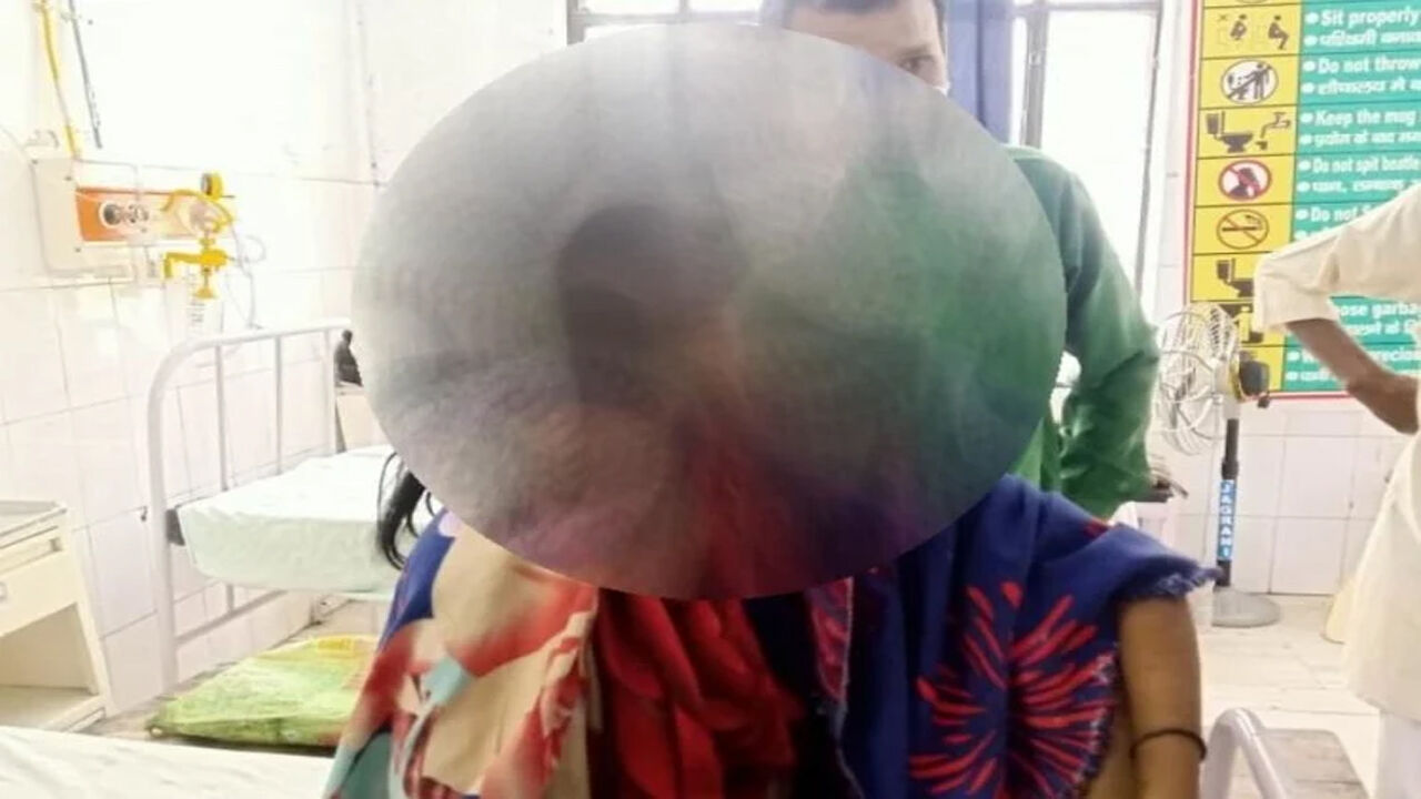 हाथरस-बलरामपुर के बाद अब गोंडा में 3 दलित बच्चियों के साथ जघन्य वारदात, सोते वक्त तेजाब फेंका, हालत गंभीर