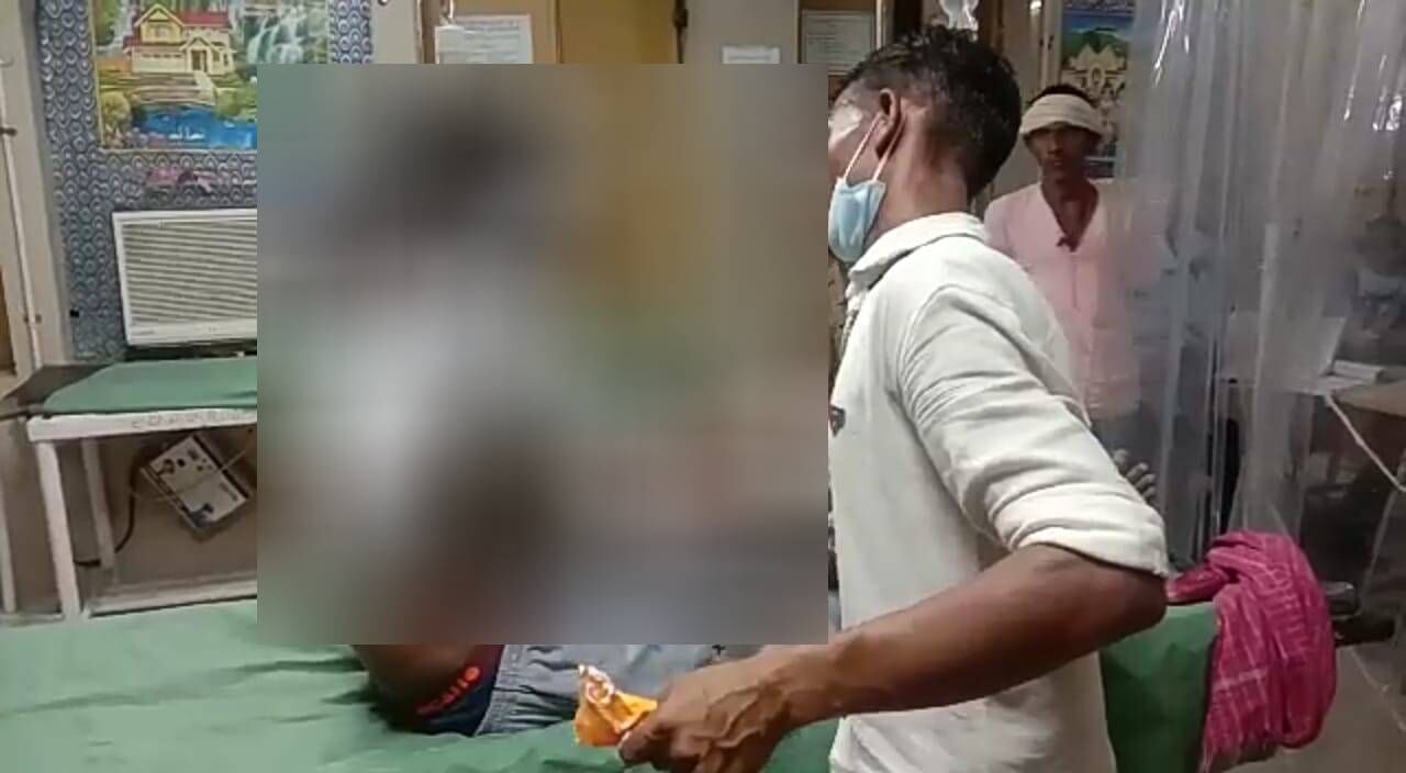 कानपुर में पुरानी रंजिश को लेकर दबंगों ने मजदूर पिता-पुत्र पर पेट्रोल डाल कर दिया आग के हवाले, हालत गंभीर