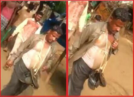 MP : बैतूल में आदिवासी लड़की से छेड़छाड़ के आरोपी व्यापारी को ग्रामीणों ने जूतों की माला पहना गांव में घुमाया