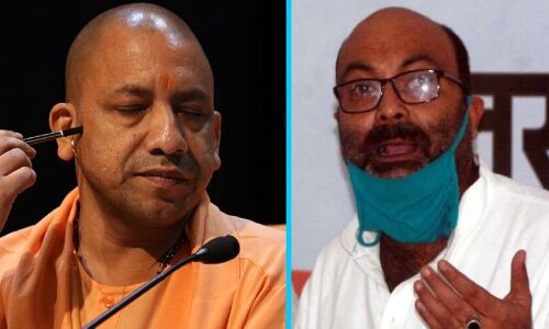 कांग्रेस का योगी पर बड़ा आरोप, मानकों में कटौती कर कुपोषण के वास्तविक आंकड़े छिपा रही है सरकार