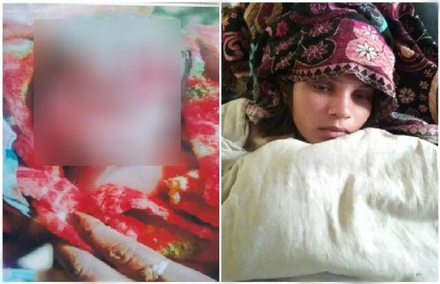 अलीगढ़ के प्राइवेट कीर्ति हॉस्पिटल में नवजात की लाश को कुतर गये चूहे, बिल वसूलने के बाद प्रबंधन ने धमकाया परिवार को