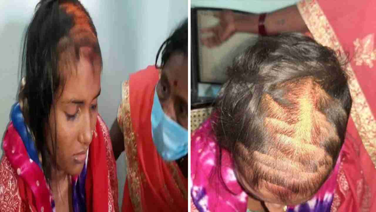 बिहार : प्रेमी की शादी से नाराज प्रेमिका ने दुल्हन के बाल काटे, आंखों में डाली फेवीक्विक