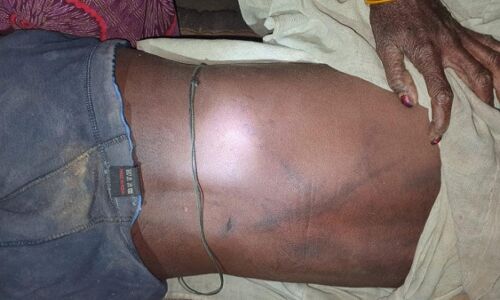 मध्य प्रदेश के छतरपुर में खाना छू लेने पर दलित युवक की बेरहमी से पीटकर हत्या