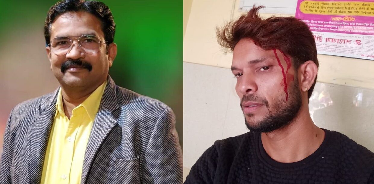 योगीराज : कानपुर में 24 घंटे के भीतर 2 पत्रकारों पर जानलेवा हमला, आरोपी फरार