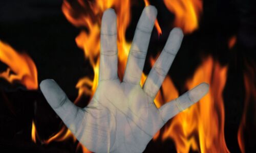 यूपी : रंजिश में व्यक्ति को कंटीले तारों से बांधकर किया आग के हवाले, एफआईआर दर्ज