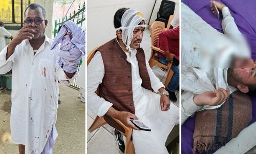 बढ़ती महंगाई, बेरोजगारी को लेकर प्रदर्शन कर रहे राजद कार्यकर्ताओं-नेताओं पर लाठीचार्ज,  हिरासत में तेजस्वी-तेजप्रताप