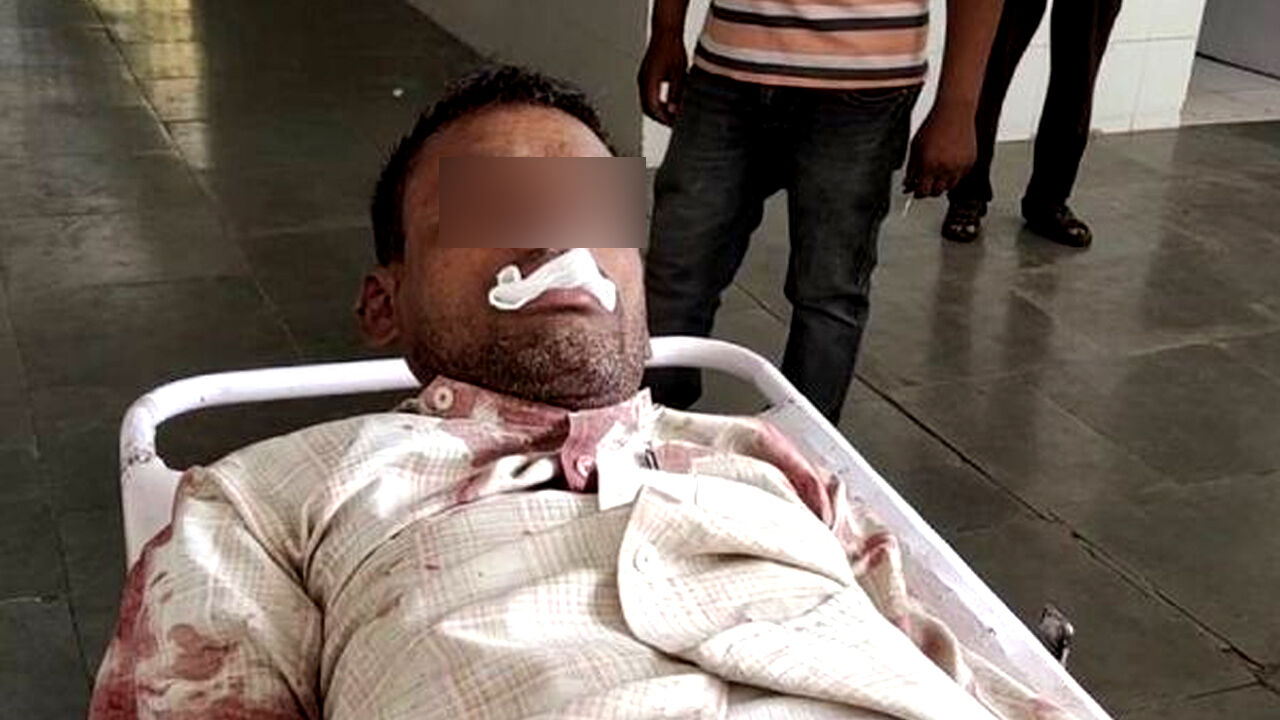 यूपी : डकैती के शक में हिरासत लिए गए संदिग्ध शख्स ने थाने में ब्लेड से काटी जीभ, पुलिस-प्रशासन के हाथ-पांव फूले