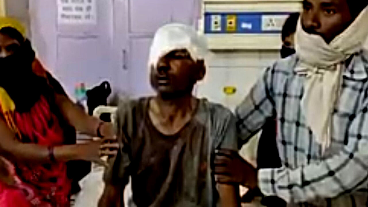 यूपी के सुल्तानपुर में कथित ऊंची जाति के गुंडों ने दलित को पीटकर किया लहूलुहान, वीडियो हुआ वायरल