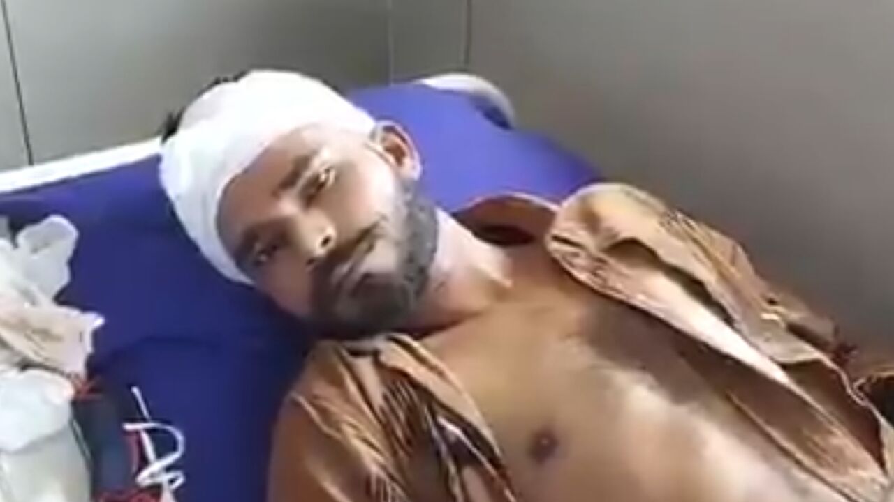 गुजरात: लम्बी मूँछे रखने पर दलित युवक पर 11 लोगों ने किया हमला, अस्पताल में भर्ती