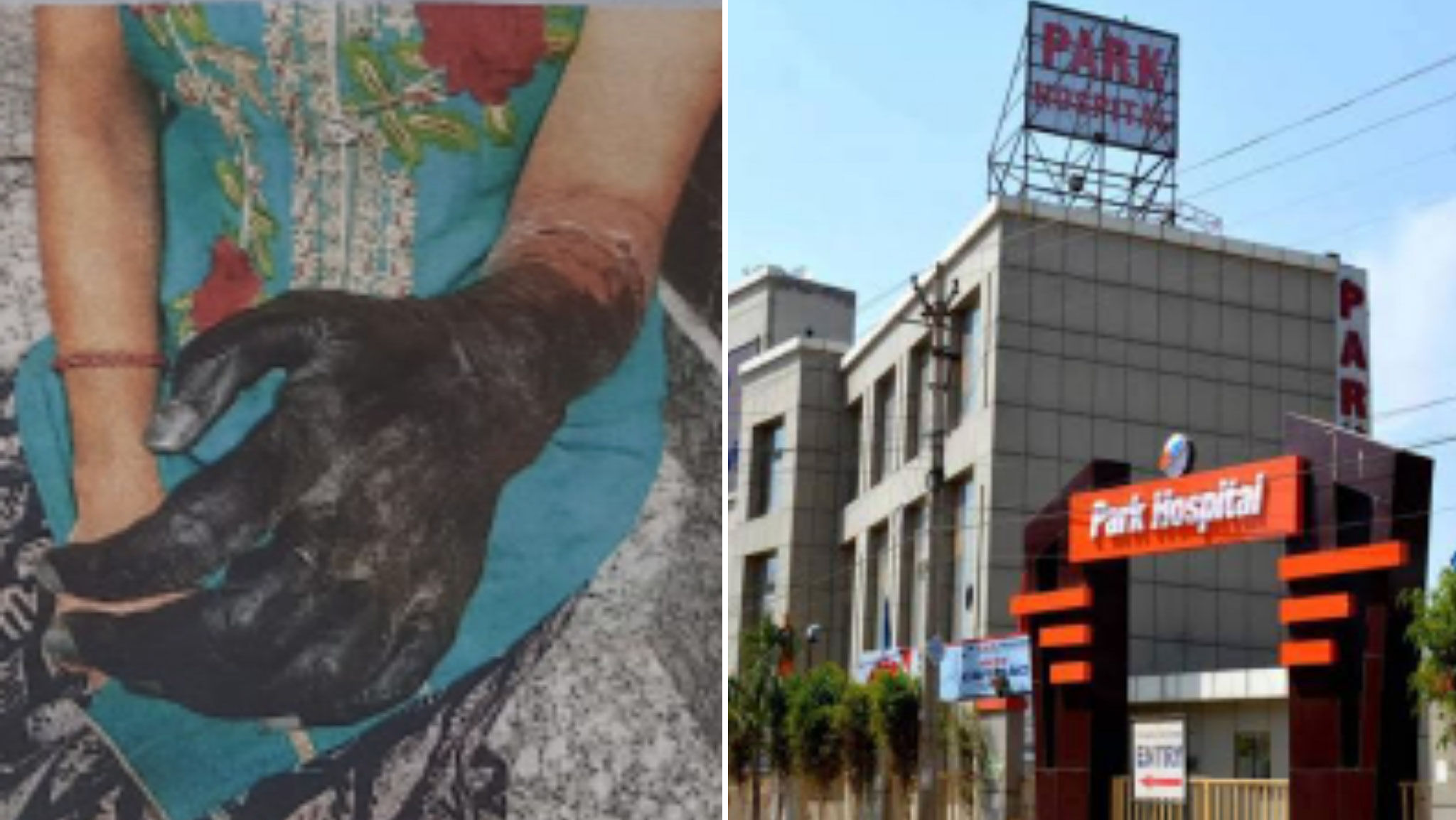 गुड़गाँव का पार्क अस्पताल गरीब दम्पत्ति के साथ कर रहा जुर्म, इन्जेक्शन की ओवेरडोज देकर ऑपरेशन के मांग रहा लाखों रूपये