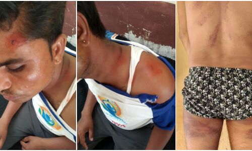 भीलवाड़ा में दलित पत्रकार की पत्नी चुनाव जीतकर बनी सरपंच तो सामंती सोच वाले ठाकुरों ने हमला कर किया लहूलुहान