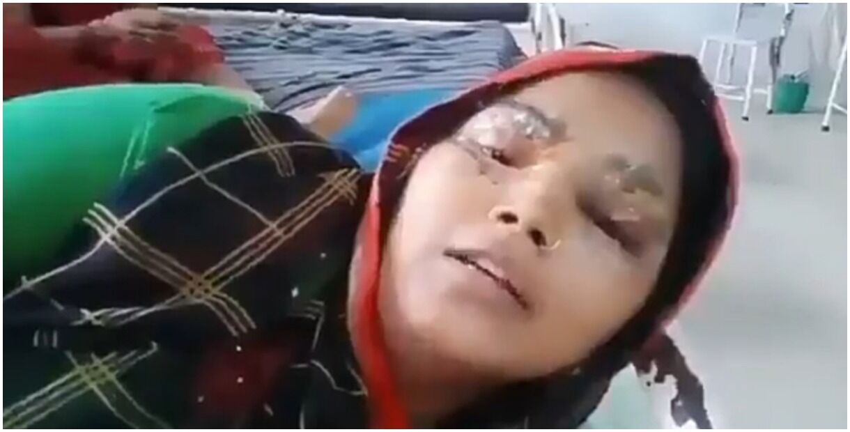 UP : सब्जी बेचने वाली महिला के साथ हैवानियत, छेड़छाड़ का किया विरोध तो गर्म चाकू से दागी आंखें, हालत गंभीर