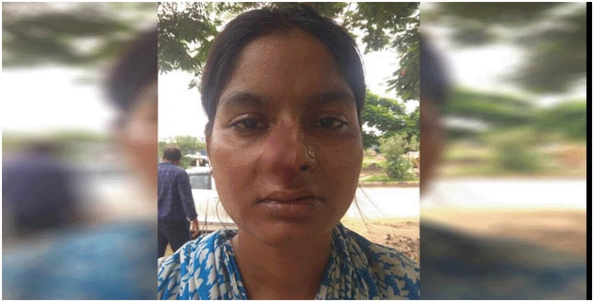 कानपुर : इस बार लक्ष्मण नहीं खर-दूषण ने काटी सुपर्णखा की नाक, अस्पताल के सामने दुकान लगाने के विवाद में चली चाकू