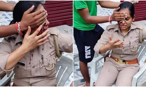 लखनऊ : मुख्यमंत्री आवास से 10 मिनट की दूरी पर महिला सिपाही से छेड़छाड़ के बाद जानलेवा हमला, आरोपी फरार