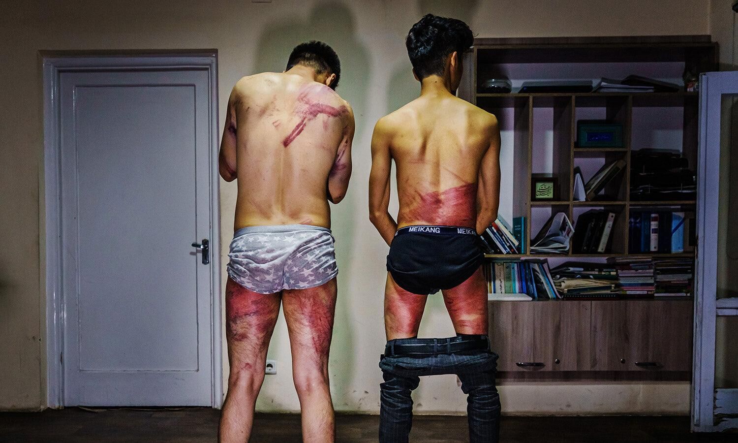 तालिबानी जुल्म की खौफनाक तस्वीर,प्रदर्शन कवर कर रहे पत्रकारों को पीट-पीटकर किया लहूलुहान तालिबानी जुल्म की खौफनाक तस्वीर,प्रदर्शन कवर कर रहे पत्रकारों को पीट-पीटकर किया लहूलुहान