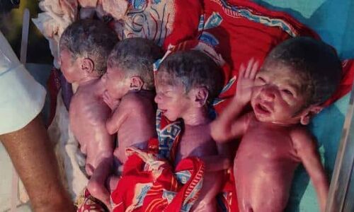 Bihar News : कुदरत का करिश्मा, बिहार में महिला ने एक साथ दिया 5 बच्चों को जन्म