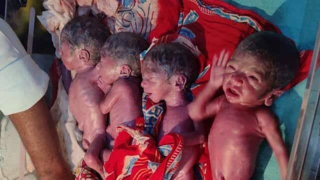 Bihar News : कुदरत का करिश्मा, बिहार में महिला ने एक साथ दिया 5 बच्चों को जन्म