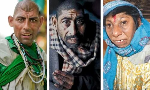 इस देश में है Rat Children की कुप्रथा, बचपन में ही ऐसे दिया जाता है इंसानी बच्चे को चूहे का रूप, फिर कराया जाता है ये घिनौना काम