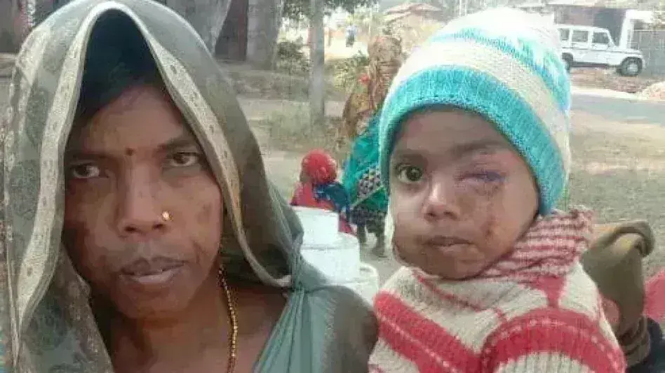 Madhya Pradesh News: तेंदुए के मुंह से खींच लाई बेटे की जिंदगी, अपनी जान जोखिम में डाल मां ने बचाई बच्चे की जान