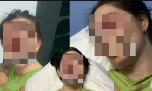 महिला ने किया छेड़छाड़ का विरोध तो बॉक्सर ने तोड़ी नाक, ताबड़तोड़ मुक्के से कई दांत भी टूटे महिला ने किया छेड़छाड़ का विरोध तो बॉक्सर ने तोड़ी नाक, ताबड़तोड़ मुक्के से कई दांत भी टूटे