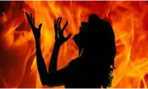 Gujarat News: महिला ने कुत्‍ते का रखा ये नाम, पड़ोसियों ने जला दिया जिंदा