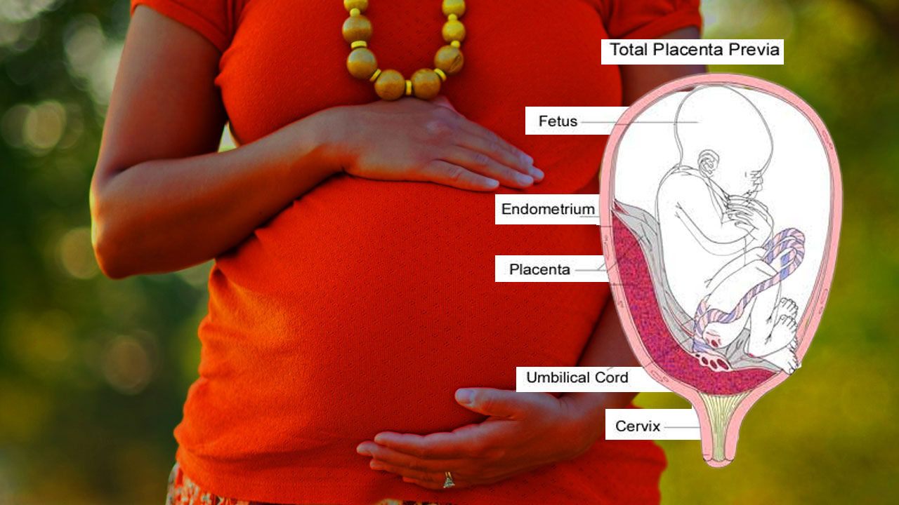 Placenta previa- Symptoms and causes: इन वजहों से मां बनने में प्लेसेंटा प्रीविया वाली समस्या आ रही, जानिए इससे कैसे बचें और कब क्या कदम उठाएं