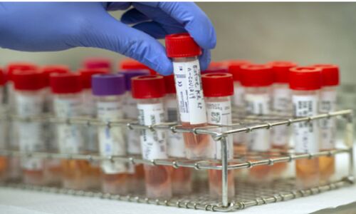 Corona testing rate Uttar pradesh Government