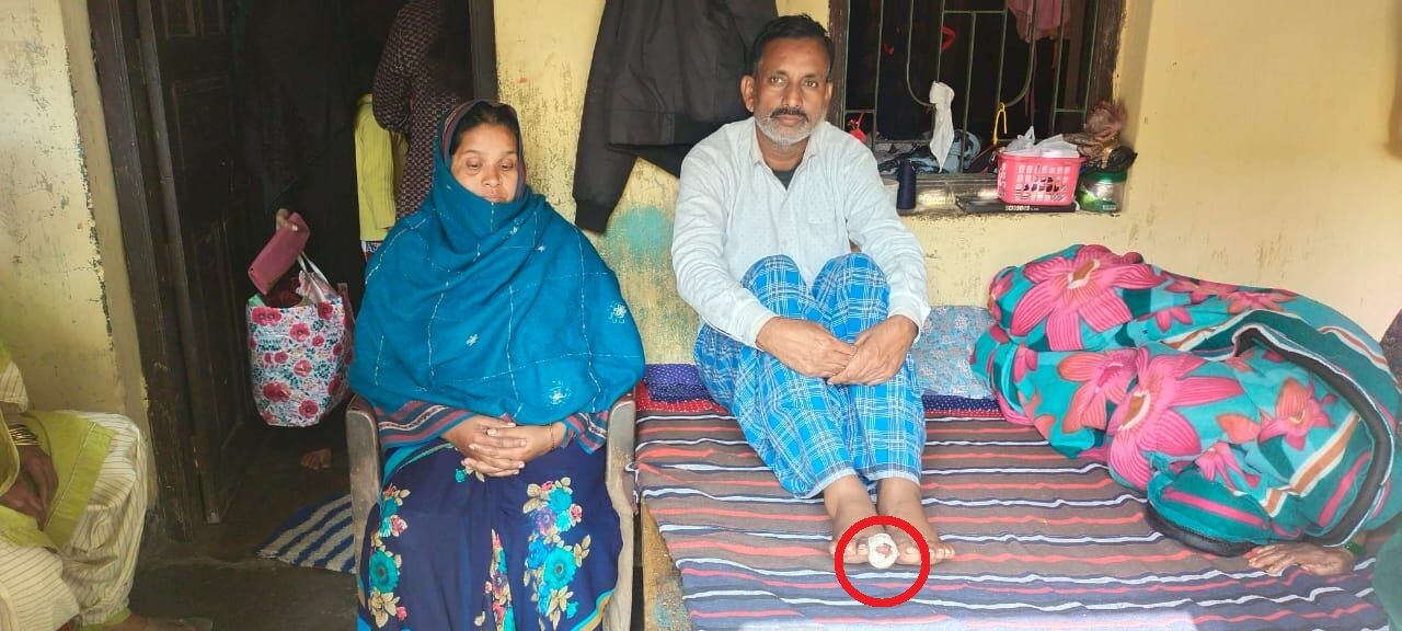 बोकारो पुलिस की हैवानियत: मुस्लिम पति-पत्नी को रात में बुलाया, दोनों के साथ अभद्रता, जमकर पिटाई, पति-पत्नी अस्पताल में भर्ती बोकारो पुलिस की हैवानियत: मुस्लिम पति-पत्नी को रात में बुलाया, दोनों के साथ अभद्रता, जमकर पिटाई, पति-पत्नी अस्पताल में भर्ती