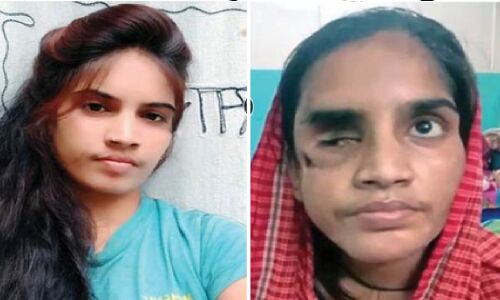 Bihar Crime News : सिरफिरे आशिक ने एकतरफा प्यार में लिया बदला, गुस्से में लड़की की फोड़ी आंख