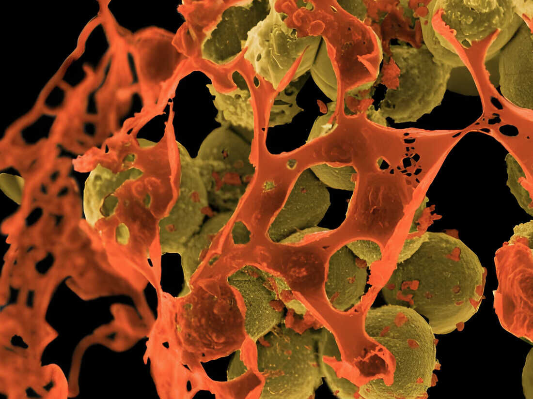 एंटीबायोटिक प्रतिरोधी बैक्टीरिया दुनिया के लिए बड़ा खतरा हैं | Antimicrobial resistance is bigger threat than HIV-AIDS & Malaria |