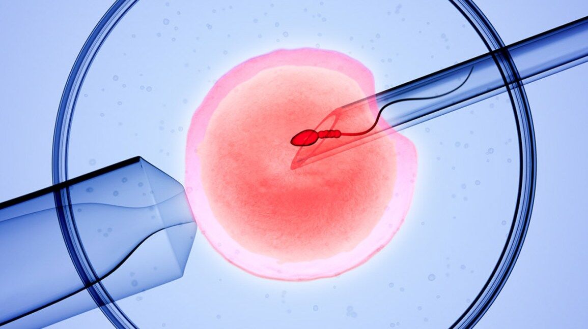 IVF Failure Ke Karan: आईवीएफ फेल होने की यह है वजह जिससे नहीं मिल पाता संतान सुख