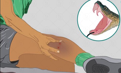 सांप का फन काटने के कितनी देर बाद तक जहर रहता है असरदार, पहली बार पढ़ें चीनी सेफ की मौत की पूरी कहानी