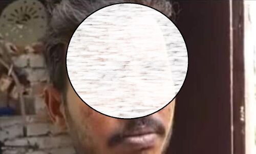 Saharanpur News: युवक का आरोप शराब पिलाकर माथे पर तेजाब से त्रिशूल बना दिया - पुलिस बोली कहानी फर्जी है