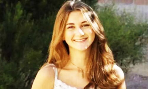 Allergic To Water : इस लड़की को है पानी से एलर्जी, आंसू बन जाते है एसिड, नहाने से जा सकती है जान