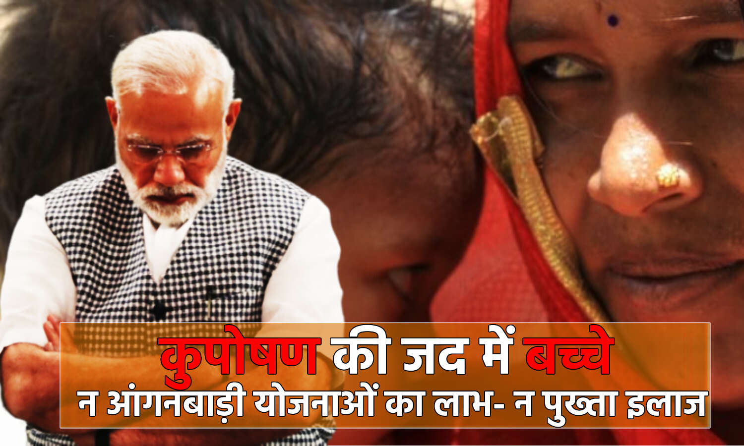 Ground Report: PM मोदी के बनारस में दर्जनभर बच्चे कुपोषण के शिकार, सो रही नौकरशाही के उड़े होश