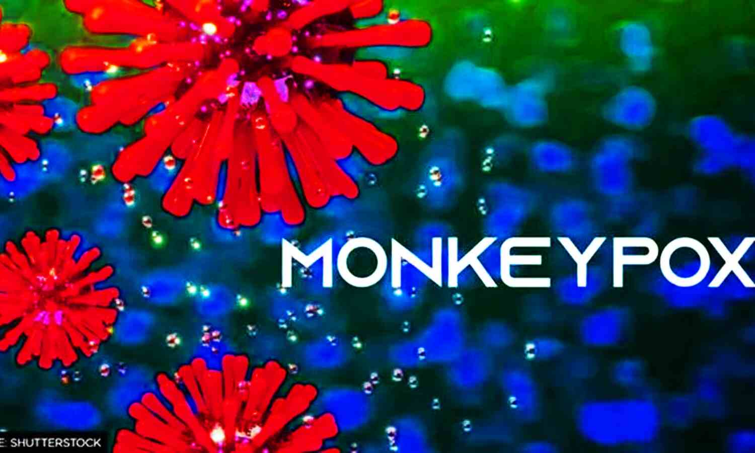 Monkeypox Alert : मंकीपॉक्स को लेकर दिल्ली में अलर्ट, सरकार ने LNJP को बनाया नोडल सेंटर