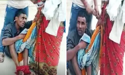 Bihar News : पागल कुत्ते के काटने पर करवाया था झाड़-फूंक, दो महीने बाद भौंकने और काटने लगा युवक