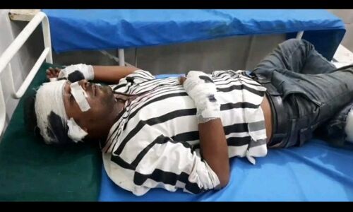 Champawat News : चलती बाइक से युवक को खींचकर ले गया गुलदार, सीएम धामी की विधानसभा का मामला