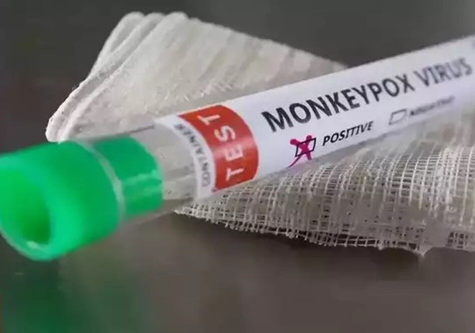 Monkeypox in Delhi: दिल्ली में मंकीपॉक्स का पहला केस आया सामने, स्वास्थ्य मंत्रालय ने की पुष्टि