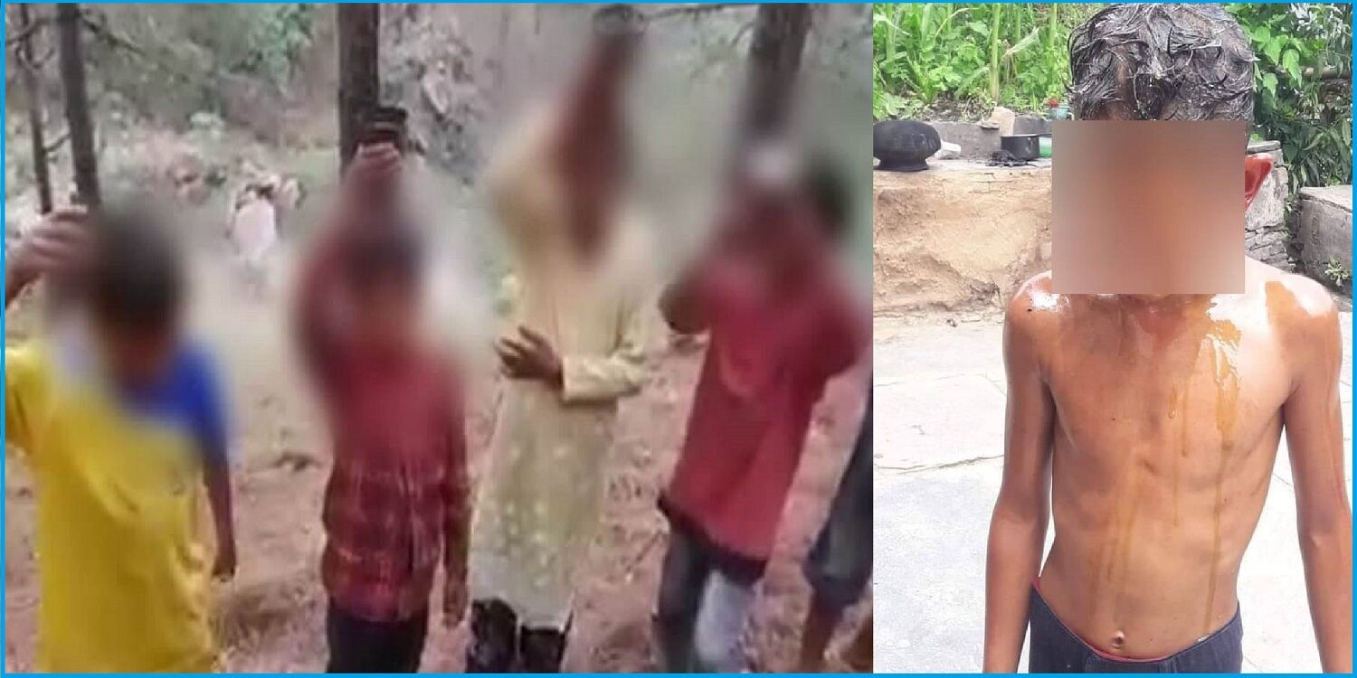 सिर से चेहरे तक पहुंचे ज्वलनशील लीसे से बच्चों की आंखों में सूजन आ गई और जलन हो होने लगी