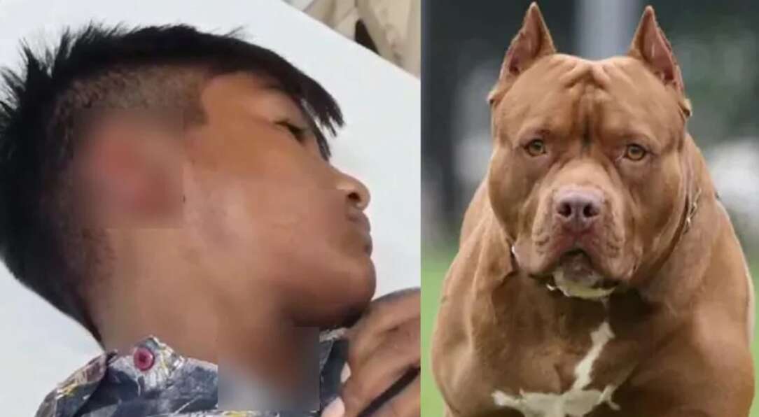 Pitbull Attack: लखनऊ के बाद अब गुरदासपुर में पिटबुल का अटैक, 13 साल के बच्चे का नोच डाला कान
