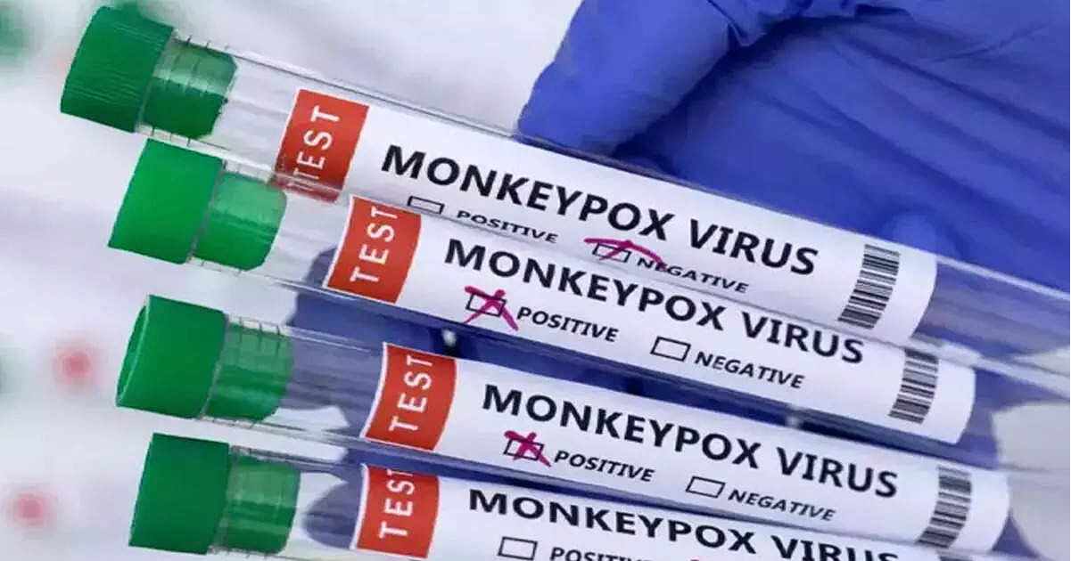 Monkeypox Death: केरल में मंकीपॉक्स के लक्षण वाले युवक की मौत, UAE में रिपोर्ट आई थी पॉजिटिव