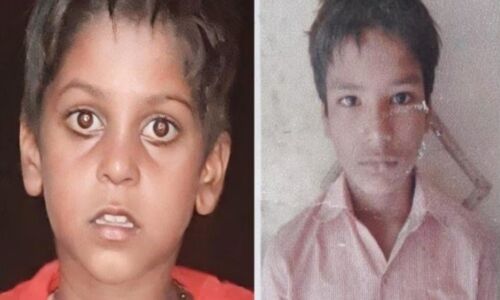 Agra News: फतेहपुर सीकरी के गांव देवरी में रहस्यमयी बीमारी से दो बच्चों की मौत, अभी भी कई बीमार